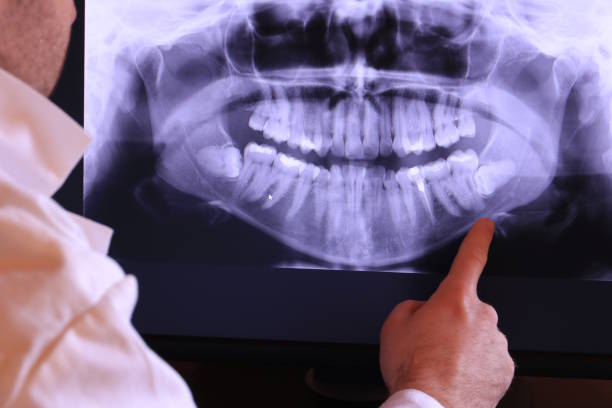 Best 24-Hour Emergency Dentist in Camp Springs, MD